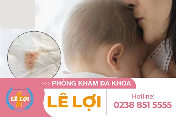 Đi cầu ra máu sau sinh phải làm sao?