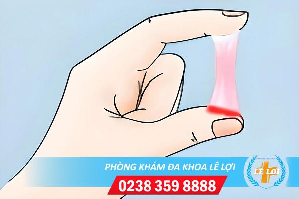 Khí hư có máu dấu hiệu bệnh lý nguy hiểm