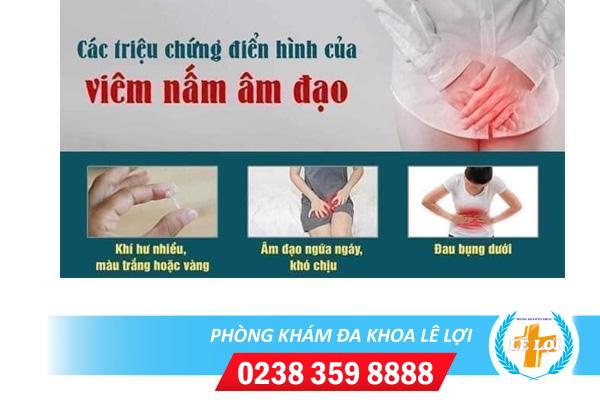 Phương pháp điều trị nấm âm đạo hiệu quả