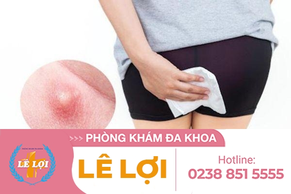 Cảm giác nhột ở hậu môn nguyên nhân và cách điều trị