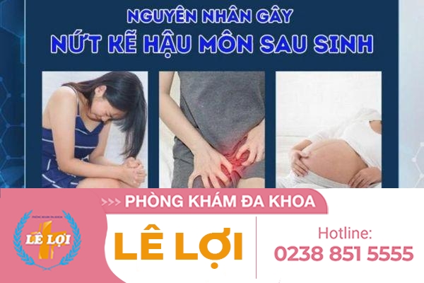 Nứt kẽ hậu môn sau sinh phải làm sao?