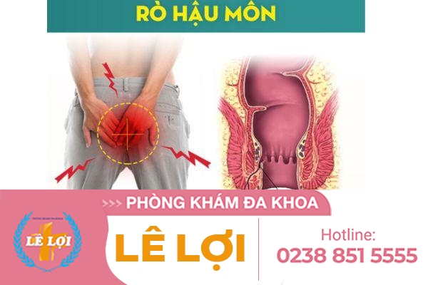 Phải làm gì khi ngứa lỗ hậu lỗ nhị?