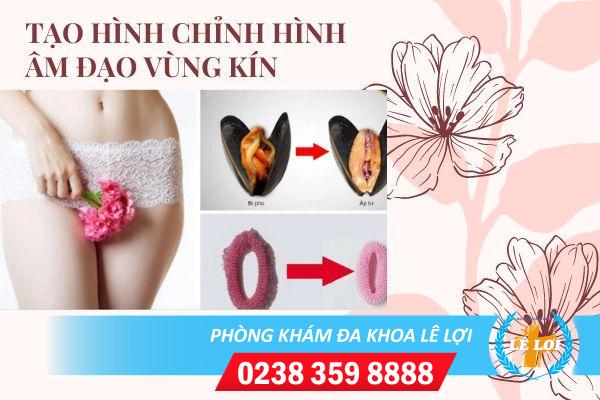 Chi phí tạo hình chỉnh hình âm đạo vùng kín