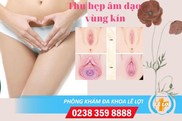 Thu hẹp âm đạo-vùng kín ở đâu tốt tại Vinh Nghệ An?