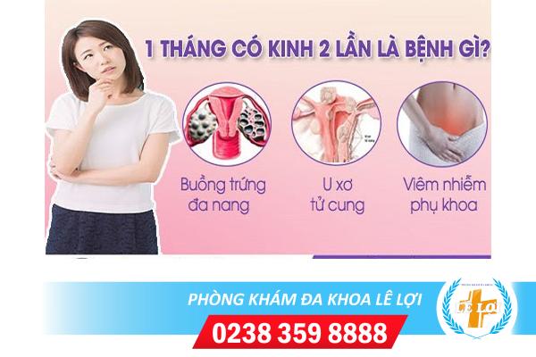 Kinh 2 lần trong 1 tháng là bị bệnh gì?