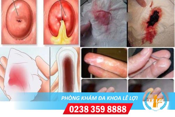 Khám vùng kín như thế nào địa chỉ uy tín