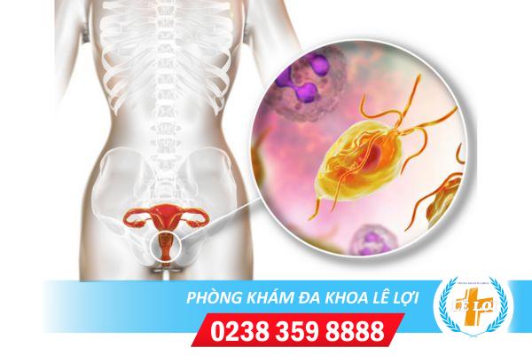 Thuốc điều trị trichomonas hiệu quả