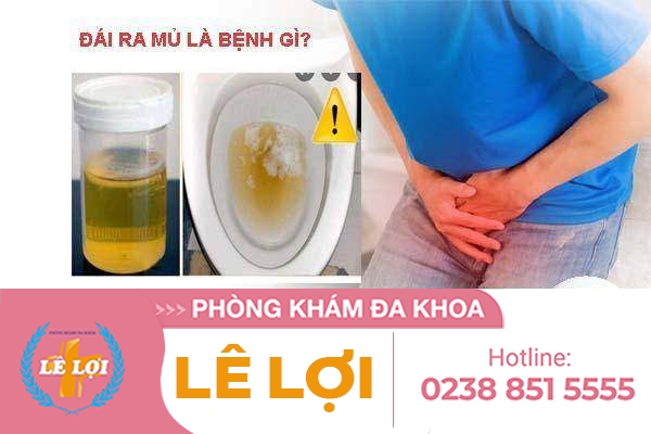Đái ra mủ là dấu hiệu bệnh gì điều trị thế nào?