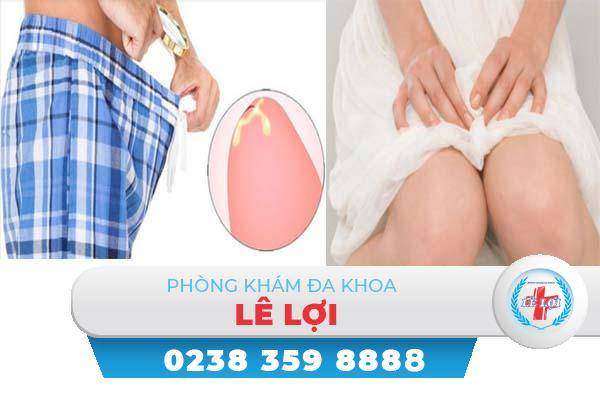 Nổi hạt trắng dương vật cảnh báo nguy hiểm
