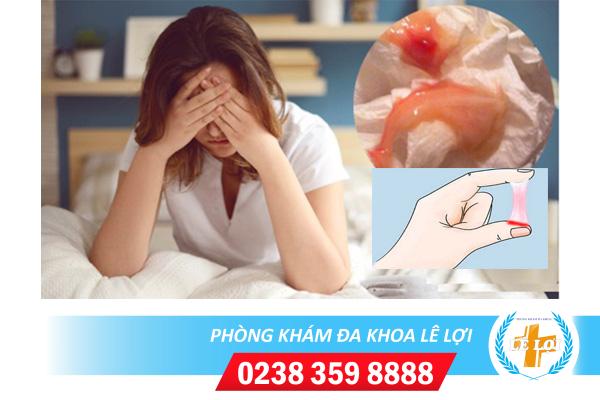 Huyết trắng màu hồng là bị bệnh gì?