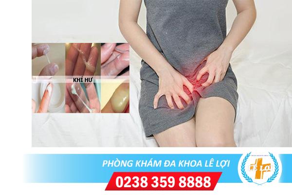 Huyết trắng ngứa nguyên nhân và cách điều trị