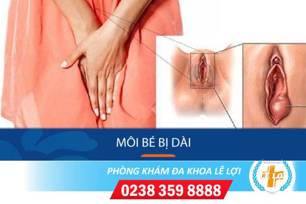 Môi bé bị dài phải làm sao?