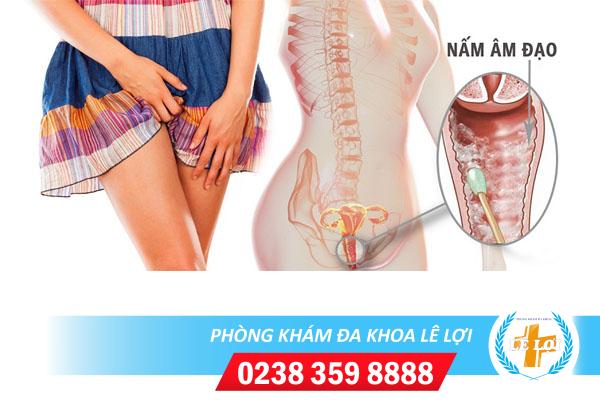 Ngứa âm hộ âm vật là bị gì?