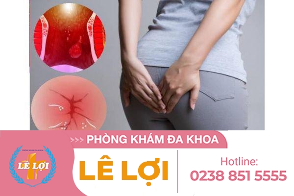 Ngứa hậu môn sau sinh là bệnh gì?
