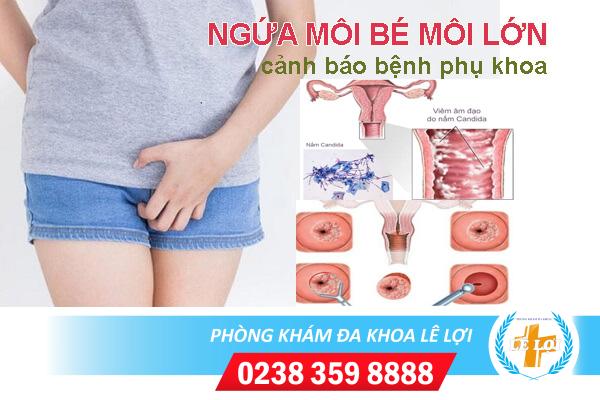 Ngứa môi bé môi lớn phải làm sao?