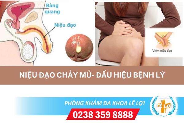 Niệu đạo chảy mủ nguy hiểm không?