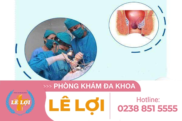 Phẫu thuật cắt trĩ thế nào chi phí ra sao?