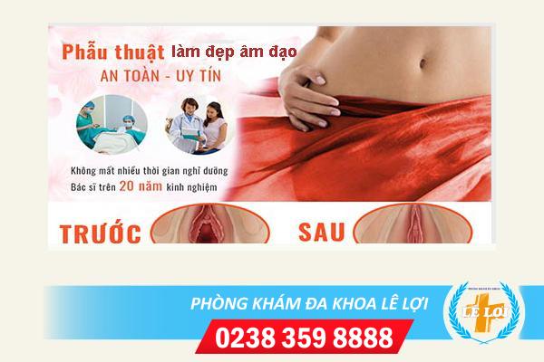 Địa chỉ làm đẹp âm đạo vùng kín tại Vinh Nghệ An