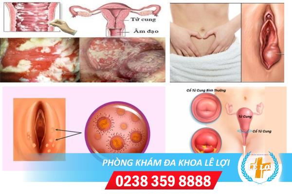 sau-quan-he-bi-ngua-sung-tieu-buot-do-benh-ly