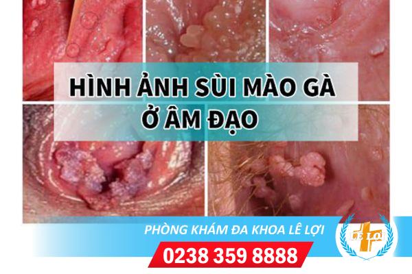 sui-mao-ga-am-dao