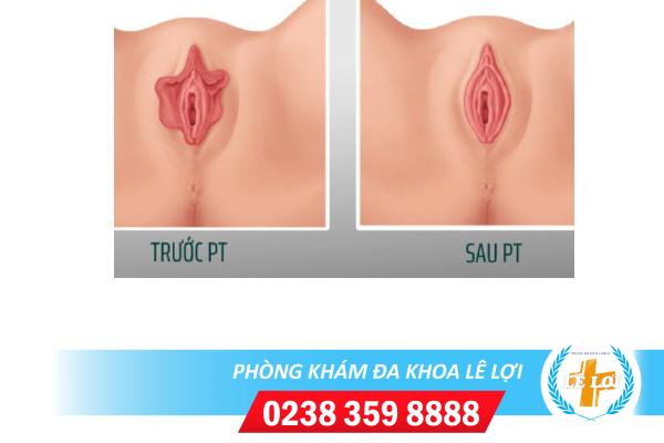 thu-nho-moi-be-moi-lon-la-gi