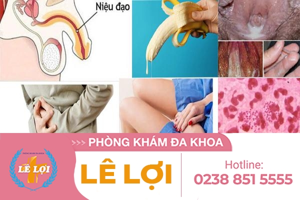 Tiết dịch niệu đạo bất thường nguyên nhân và cách điều trị