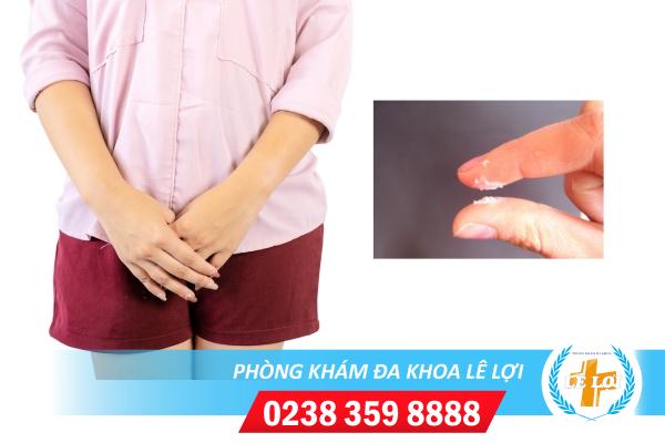 Nguyên nhân và cách điều trị khí hư huyết trắng dạng bột