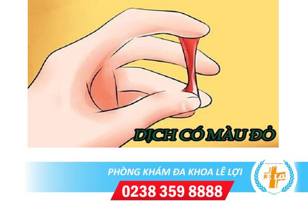 Dịch âm đạo màu đỏ có máu nguy hiểm không?