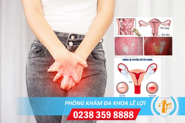 Ngứa bướm ngứa bím là bệnh gì?