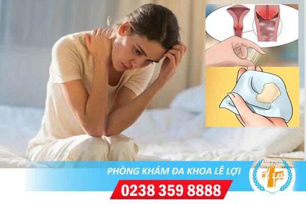 Hình ảnh cô bé bị viêm và cách điều trị hiệu quả