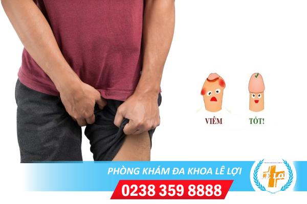 Bao quy đầu đau rát là bị bệnh gì?