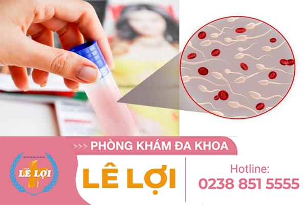 Nguyên nhân tinh trùng có máu và cách điều trị