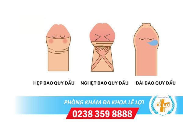 dau-hieu-benh-ly-bao-quy-dau
