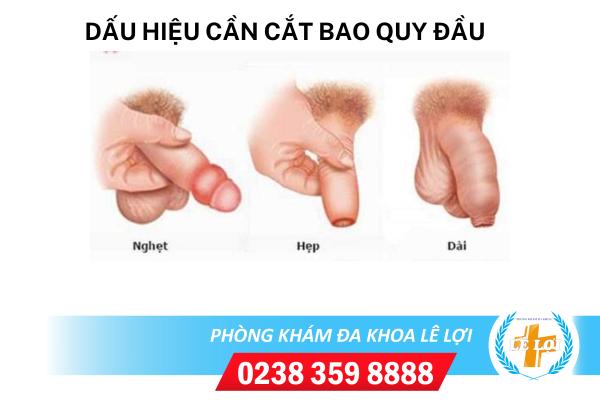 dau-hieu-can-cat-bao-quy-dau