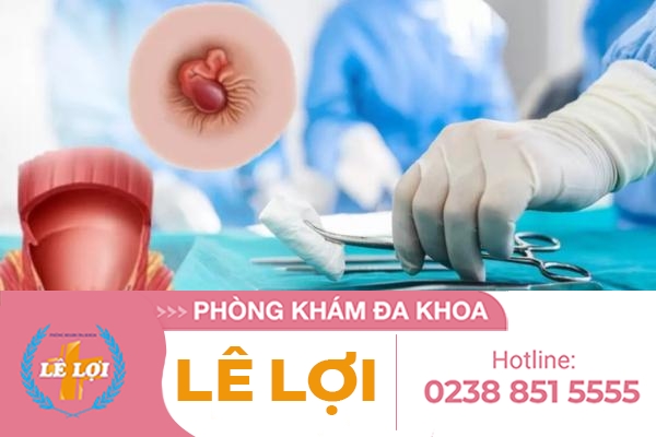 Cắt trĩ bằng phương pháp nào có đau không?