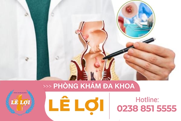 Phương pháp cắt trĩ hiệu quả an toàn