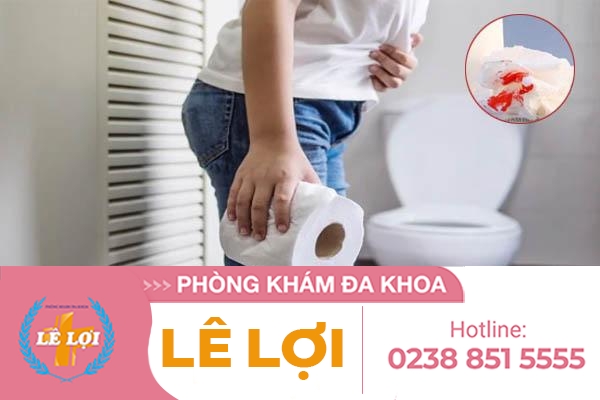 Tại sao đi vệ sinh ra máu và cách điều trị?