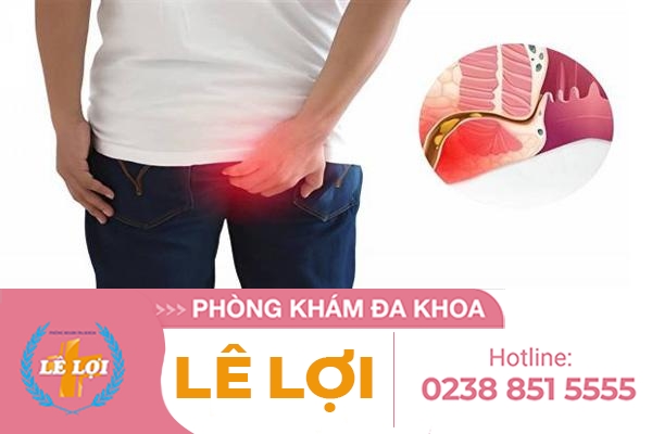 Nóng rát hậu môn là bị bệnh gì?