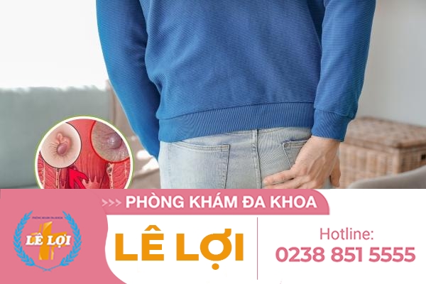 Sa hậu môn là bệnh gì nguy hiểm không?