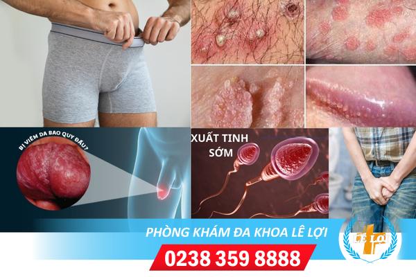 Dấu hiệu mắc bệnh dương vật và cách điều trị