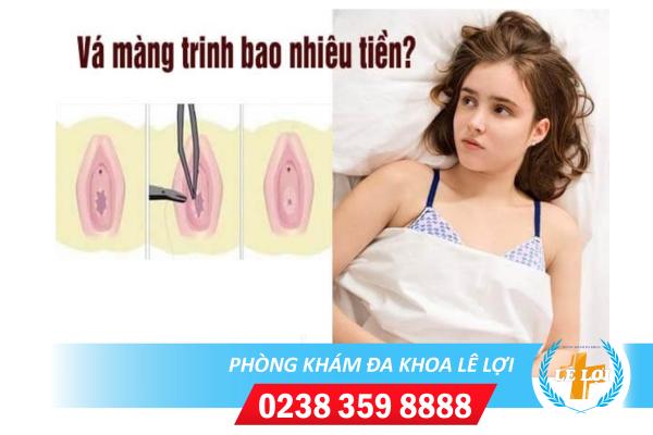 Vá trinh bao nhiêu tiền?