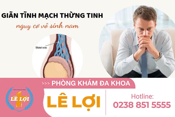 Giãn tĩnh mạch thừng tinh có gây vô sinh không?