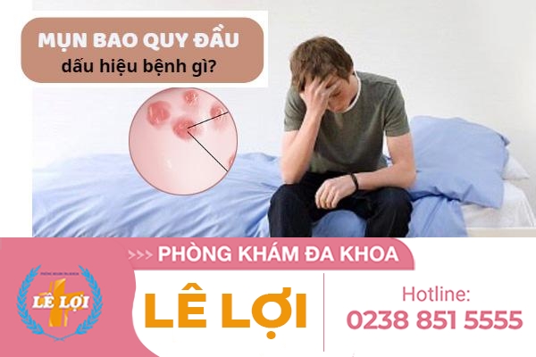 Mụn bao quy đầu có sao không cách điều trị thế nào?
