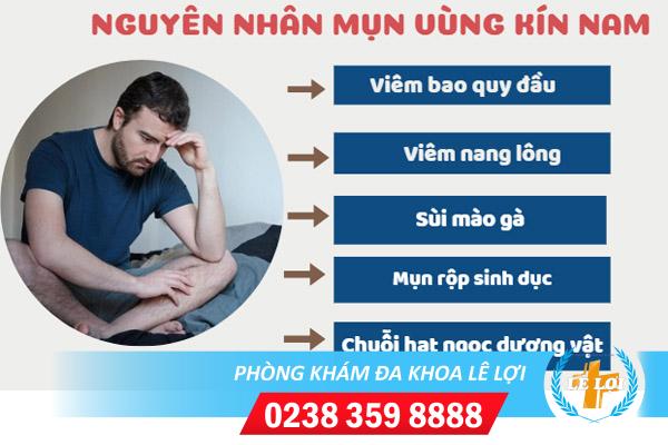 Mụn vùng kín nam nguyên nhân và cách điều trị