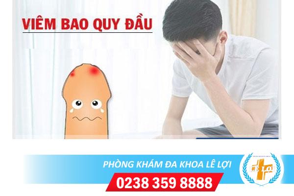 Viêm bao quy đầu và cách xử lý an toàn hiệu quả