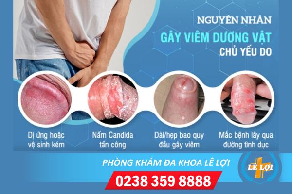 viem-duong-vat (1)