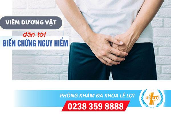 Dấu hiệu viêm dương vật ở nam và cách chữa trị
